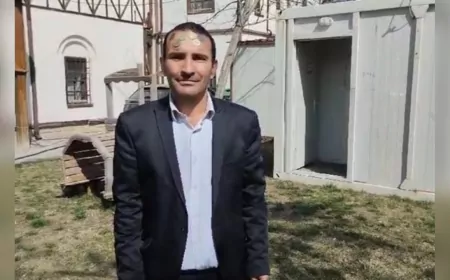 Malatyalı "Mıknatıs Adam" Guinness Rekorlar Kitabı'na Başvurdu