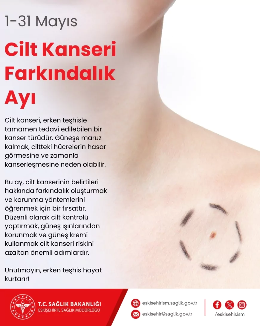 Doç. Dr. Yaşar Bildiriciden Cilt Kanserine Karşı Uyarı