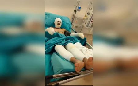 Seyitgazi Yangınında Yaralanan Orman İşçisi Kader Dereli’nin Tedavisi Sürüyor