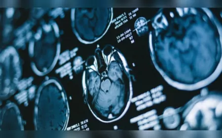 Covid-19 Dönemi Beyin Yaşlanmasını Hızlandırdı: Ortalama 5,5 Ay