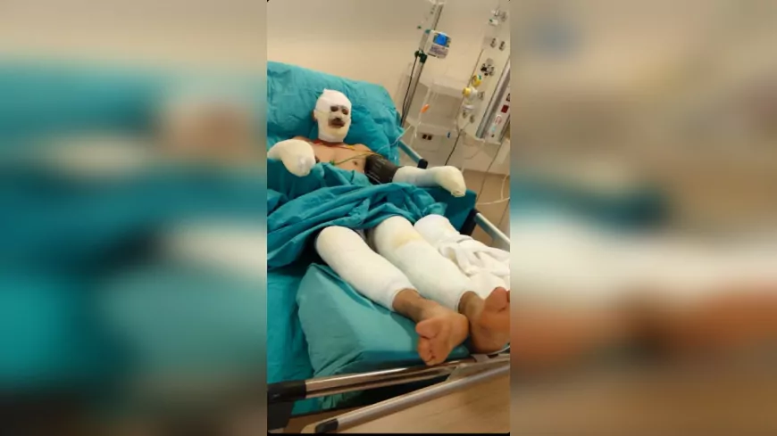 Seyitgazi Yangınında Yaralanan Orman İşçisi Kader Dereli’nin Tedavisi Sürüyor